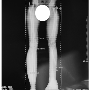 Martin_before X-ray.jpg